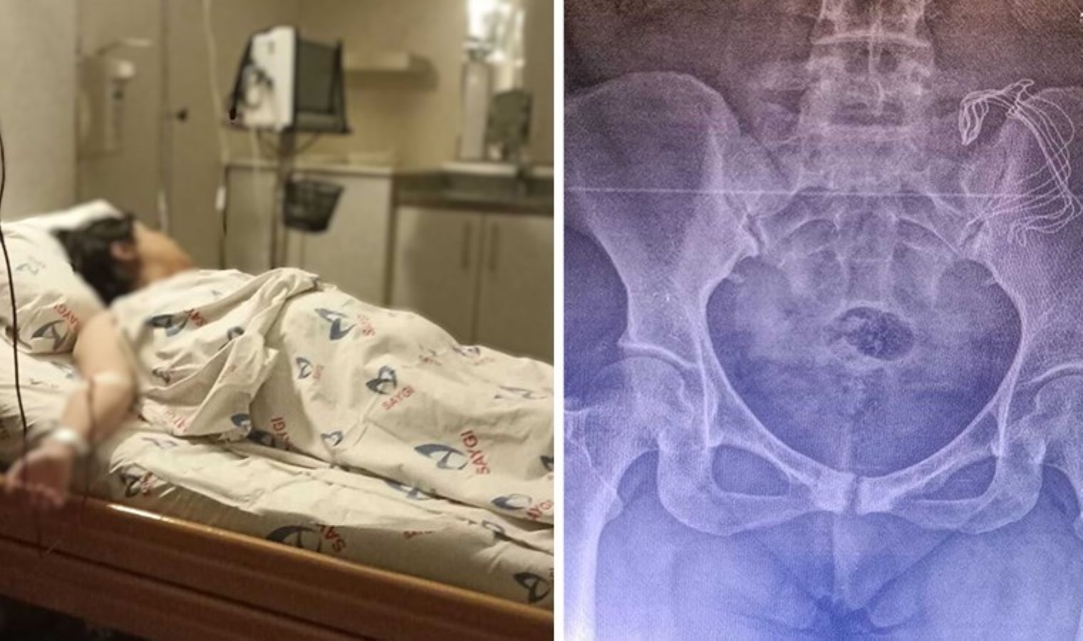 İstanbul’da özel hastanede pes dedirten olay: Doğumda vücudunda unutulan gazlı bez 10 ay sonra fark edildi