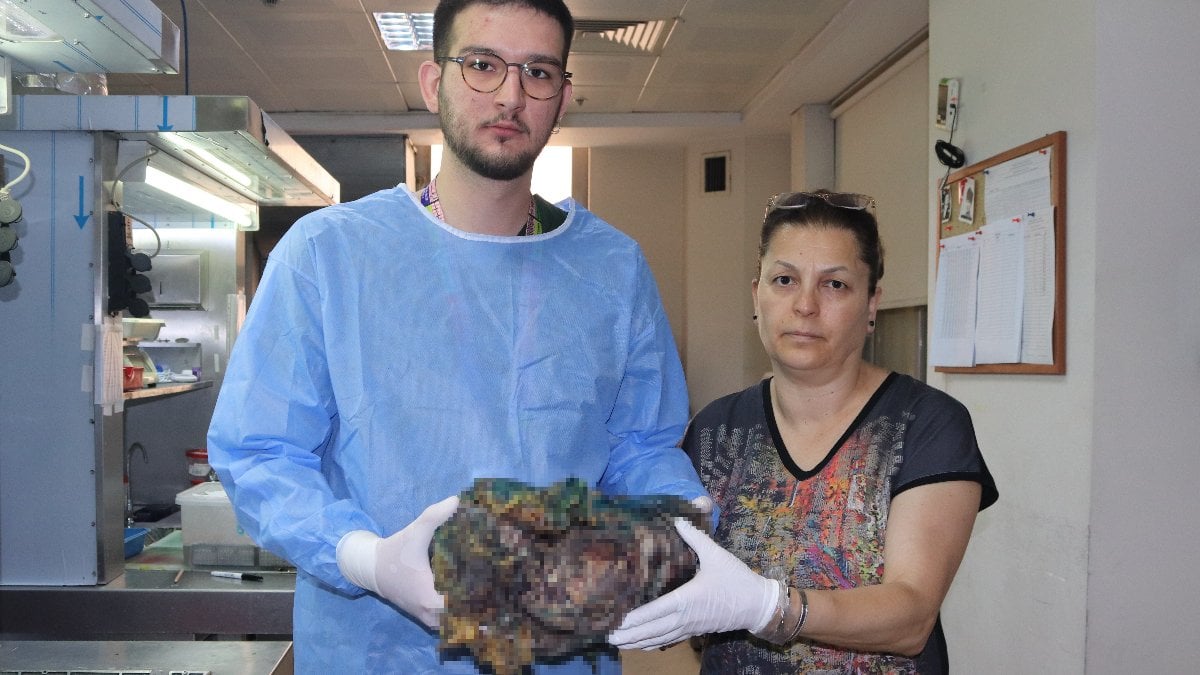 İzmir’de karın ağrısı ile hastaneye gitti, 10 kiloluk dev tümör çıkartıldı